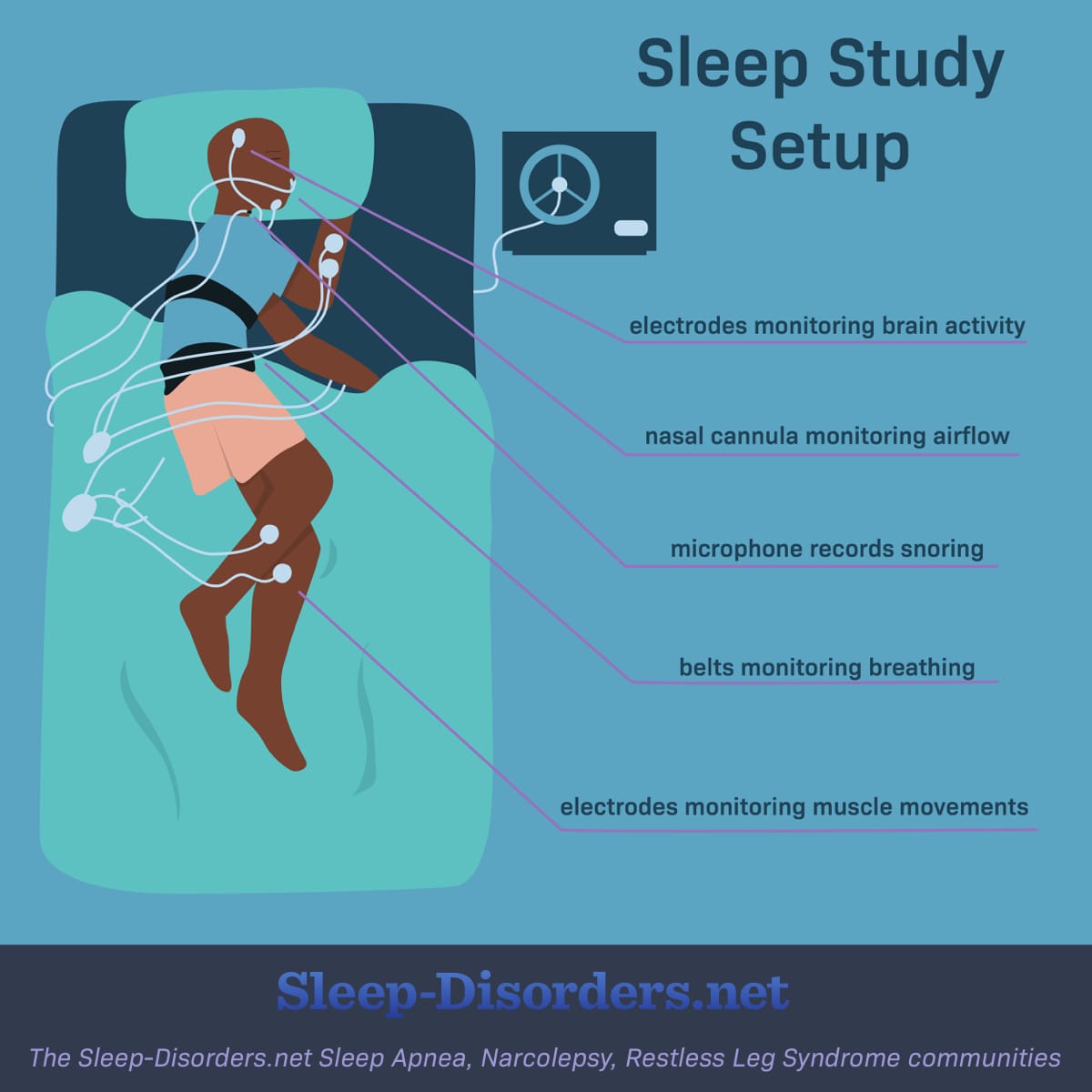 What Is a Sleep Study (Polysomnography)?